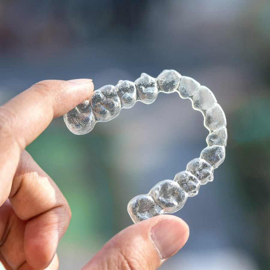 What is Invisalign? Fraser Valley Orthodontics in Langley City